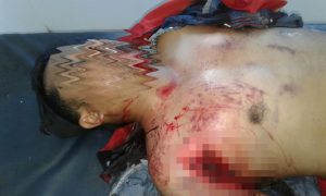 Tabrak Truck, Pengendara Roda Dua Luka-luka